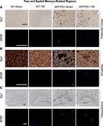 GFAP Antibody in Immunohistochemistry (IHC)