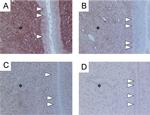 Estrogen Receptor beta Antibody in Immunohistochemistry (IHC)