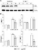 TLR4/MD-2 Complex Antibody in Western Blot (WB)