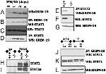 Grim-19 Antibody in Western Blot (WB)