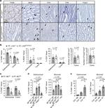 FOXP3 Antibody in Immunohistochemistry (IHC)