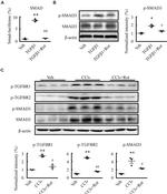 Phospho-TGFBR1 (Ser165) Antibody in Western Blot (WB)