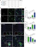 IBA1 Antibody in Immunocytochemistry, Immunohistochemistry (ICC/IF, IHC)