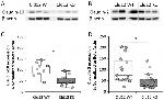 Claudin 10 Antibody in Western Blot (WB)