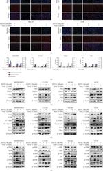 Ferroportin Antibody in Western Blot (WB)