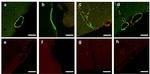 beta Amyloid (1-40) Antibody in Immunohistochemistry (IHC)