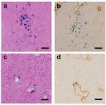 beta Amyloid (1-40) Antibody in Immunohistochemistry (IHC)