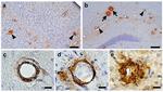 beta Amyloid (1-40) Antibody in Immunohistochemistry (IHC)