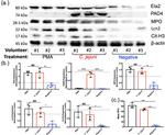 NGAL Antibody in Western Blot (WB)