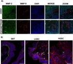 MMP2 Antibody in Immunohistochemistry (IHC)