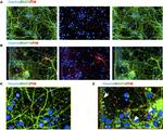 MAP1B Antibody in Immunocytochemistry (ICC/IF)