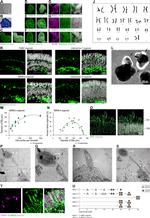 SSEA4 Antibody in Immunocytochemistry (ICC/IF)