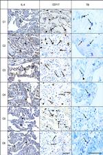 IL-4 Antibody in Immunohistochemistry (IHC)