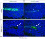 Versican V0, V1 Neo Antibody in Immunocytochemistry, Immunohistochemistry (PFA fixed) (ICC/IF, IHC (PFA))