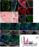 mCherry Antibody in Immunocytochemistry (ICC/IF)