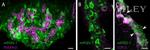 CD140b (PDGFRB) Antibody in Immunohistochemistry (IHC)