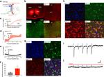 VGLUT2 Antibody in Immunocytochemistry, Immunohistochemistry (ICC/IF, IHC)