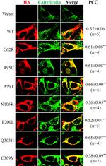 HA Tag Antibody in Immunocytochemistry (ICC/IF)