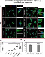 Tau Antibody in Immunocytochemistry (ICC/IF)