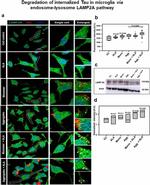 Tau Antibody in Immunocytochemistry (ICC/IF)