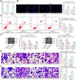 Bax Antibody in Western Blot (WB)