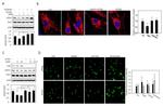 Calcineurin A Antibody in Western Blot (WB)