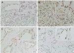 SOX2 Antibody in Immunohistochemistry (IHC)