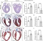 Cardiac Troponin T Antibody in Immunohistochemistry (PFA fixed) (IHC (PFA))