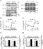 STIM2 Antibody in Western Blot (WB)