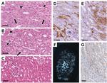 LAMP-2A Antibody in Immunohistochemistry (IHC)