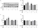 Phospho-AKT1 (Ser473) Antibody in Western Blot (WB)