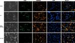 ACE2 Antibody in Immunocytochemistry (ICC/IF)