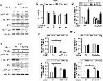 Estrogen Receptor alpha Antibody in Western Blot (WB)