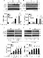 Phospho-p47phox (Ser304) Antibody in Western Blot (WB)