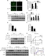 Phospho-p47phox (Ser304) Antibody in Western Blot (WB)