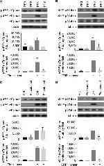 Phospho-p47phox (Ser304) Antibody in Western Blot (WB)