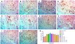 Caspase 3 Antibody in Immunohistochemistry (IHC)