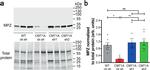 MPZ Antibody in Western Blot (WB)