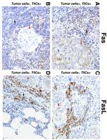 Fas Antibody in Immunohistochemistry (IHC)