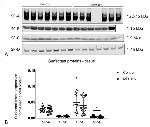 SFTPA1 Antibody in Western Blot (WB)