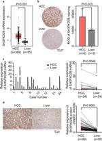 SH3PXD2B Antibody in Immunohistochemistry (IHC)