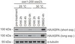 Aspartoacylase Antibody in Western Blot (WB)