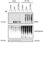 Aspartoacylase Antibody in Western Blot (WB)