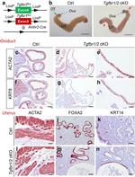 Cytokeratin 14 Antibody in Immunohistochemistry (IHC)