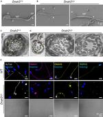 DNAH2 Antibody in Immunohistochemistry (IHC)