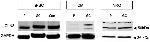 CLN3 Antibody in Western Blot (WB)