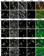 MBP Antibody in Immunocytochemistry (ICC/IF)