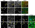 MBP Antibody in Immunohistochemistry (IHC)