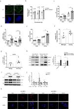 Apolipoprotein J Antibody in Western Blot (WB)