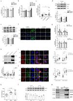 Apolipoprotein J Antibody in Western Blot (WB)